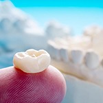 Ceramic dental crown resting on person’s fingertip