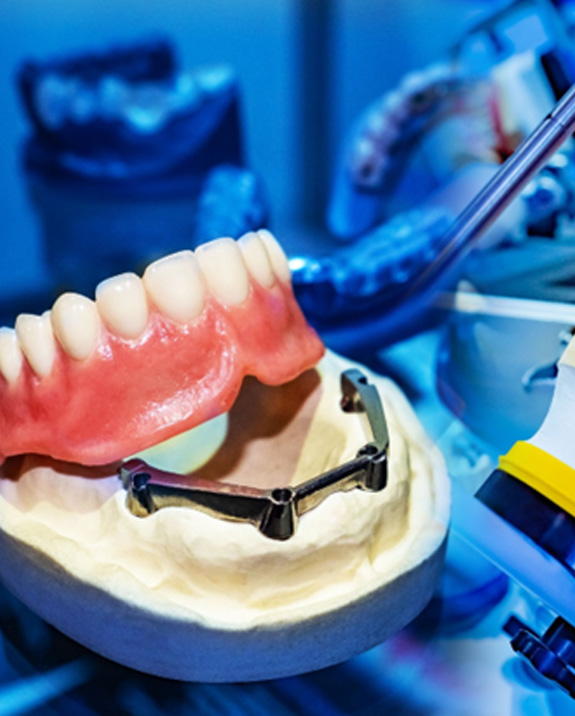 Here’s how your new dentures will be made
