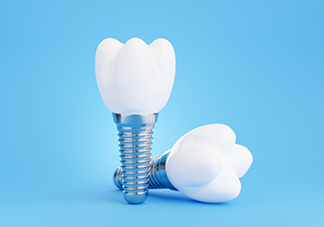 Illustration of two dental implants against a blue background