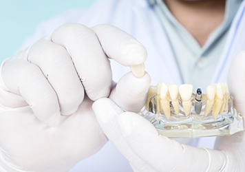 Dentist placing a crown over a dental implant in a model of the mouth