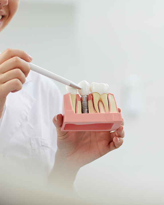 Dentist showing a dental implant model to a patient