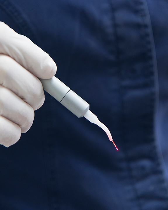 Close up of a dentist holding a metal pen like dental laser device