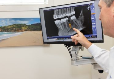 Dentist showing a patient an x ray of their teeth