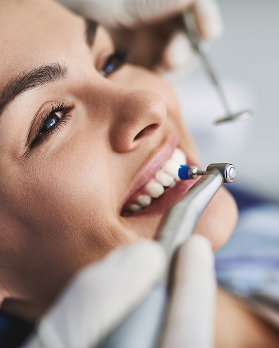 Close up of a woman receiving a preventive dentistry cleaning