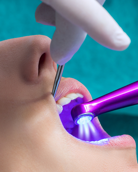 Close up of a dental patient having an ultraviolet light shone onto their teeth