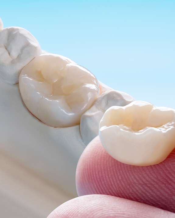 Close up of a dental crown resting on a finger