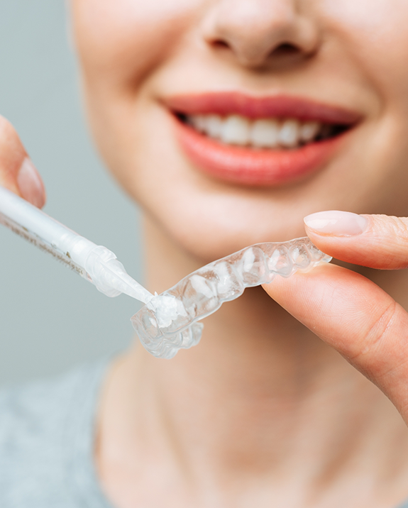 Person placing bleaching gel in a teeth whitening tray