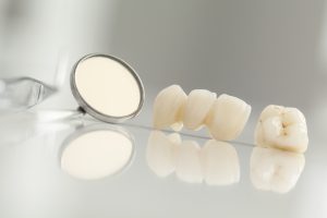 Dental bridges in Ellington replace missing teeth