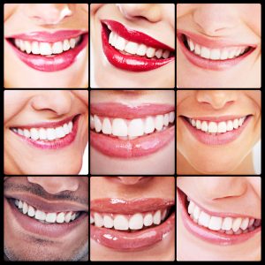 Cracks, stains, and other defects spoil smiles. Your cosmetic dentist in Ellington at Zahner Dental transforms flaws so you look and feel your best.