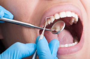 a patient during a dental checkup